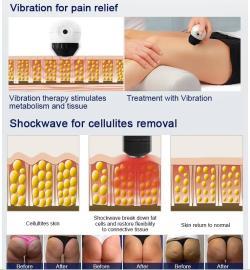 Аппарат для физиотерапии ESWT ультразвуковой (арт. 25-19081478)