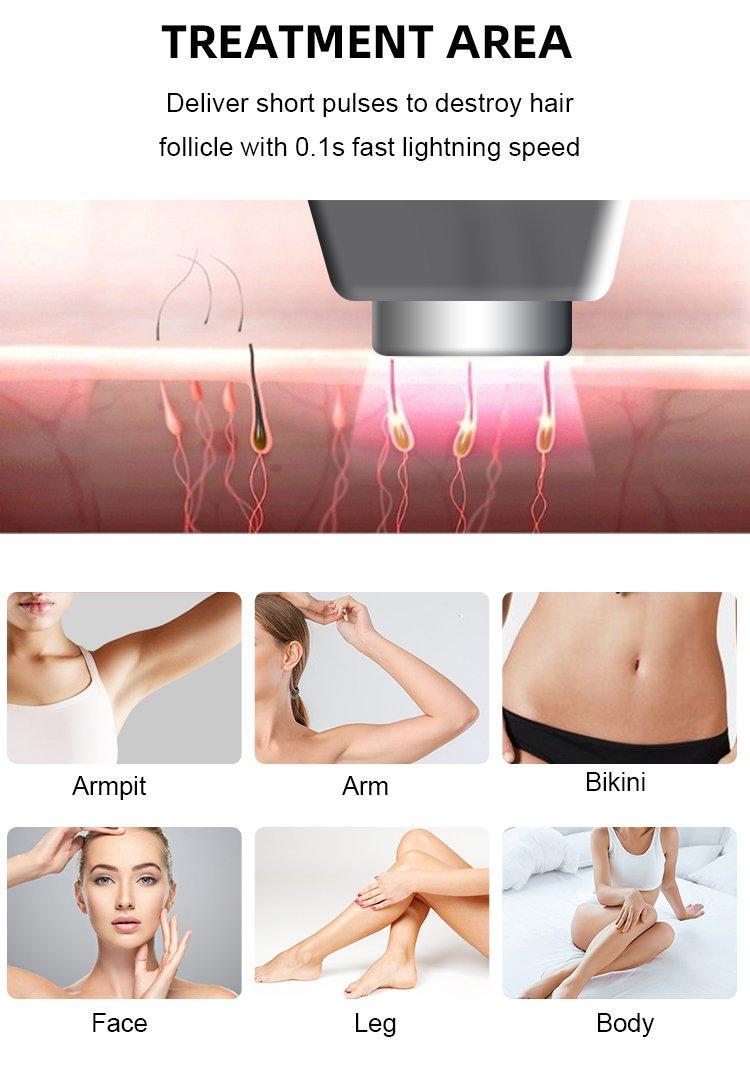 Лазерная машина для удаления тройной длины волны 755 808 1064 нм (арт. 25-19081532)