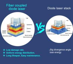 Вертикальный диодный лазер для удаления волос высокой эффективности (арт. 25-19081600)