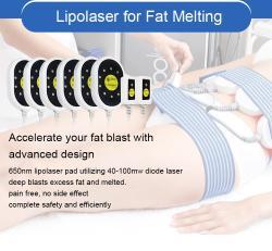 Аппарат для криолиполиза RF 360 для похудения и уменьшения целлюлита (арт. 25-19081676)