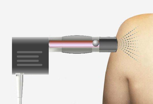 Аппарат для физиотерапии ESWT 6 Бар 20Гц для снятия боли (арт. 25-19081782)