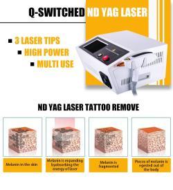 Лазерный аппарат для тату и карбонового пилинга 1064nm 532nm (арт. 25-19081898)